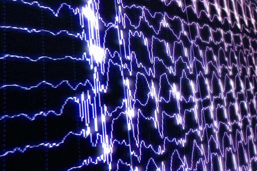 brain waves in rem sleep